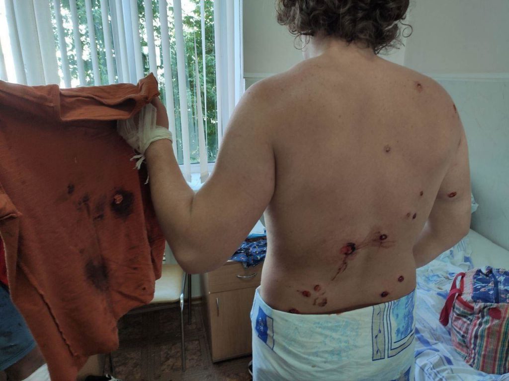 Rany protestujących od granatów, strzałów i pałek OMONu